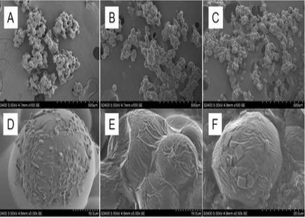 Chitosan/citric acid/NaCl microparticles under different magnifications(另開新視窗/jpg檔)